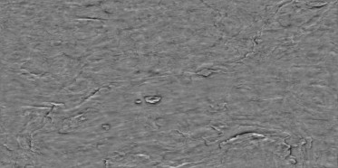 Bump (disp. depth 2.3mm)