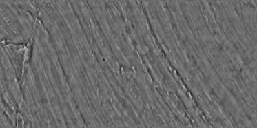 Bump (disp. depth 3.8mm)