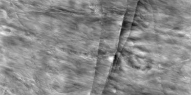 Bump (disp. depth 11.5mm)