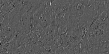 Bump (disp. depth 2.5mm)