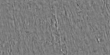 Bump (disp. depth 7.5mm)