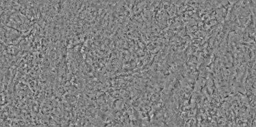 Bump (disp. depth 8mm)