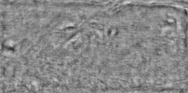 Bump (disp. depth 4mm)