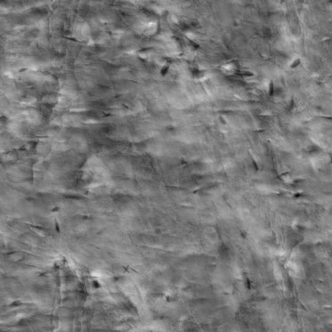 Bump (disp. depth 12mm)