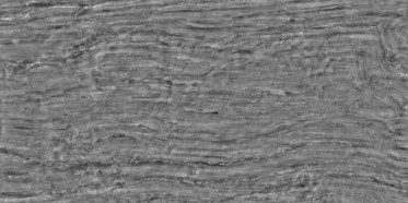 Bump (disp. depth 6mm)