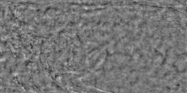 Bump (disp. depth 3.8mm)