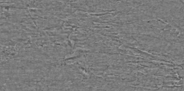 Bump (disp. depth 4.6mm)