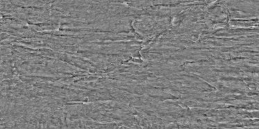 Bump (disp. depth 5mm)